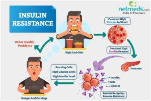 Flowchart-style diagram showing insulin resistance development due to high sugar, free fatty acids, and effects on metabolic health.