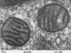“Transmission electron micrograph showing multiple mitochondria in mammalian lung tissue.”