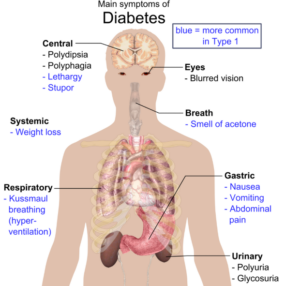 “Illustration: common symptoms of diabetes (e.g. thirst, polyuria, fatigue)”