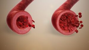 “Side-by-side illustration of a narrowed artery versus a relaxed, widened artery with smoother blood flow.”