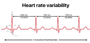 ECG waveform illustrating heart rate variability intervals between beats.