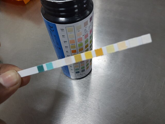 Urinalysis dipsticks beside a urine sample cup, illustrating cloudy urine in women assessment.