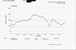 Example of a continuous glucose monitoring trend over time