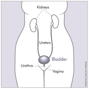 NCI illustration of the female bladder and nearby organs relevant to cloudy urine in women during pregnancy.