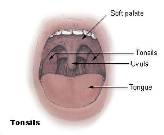 Anatomical diagram of tonsils and throat showing palatine tonsils and surrounding structures