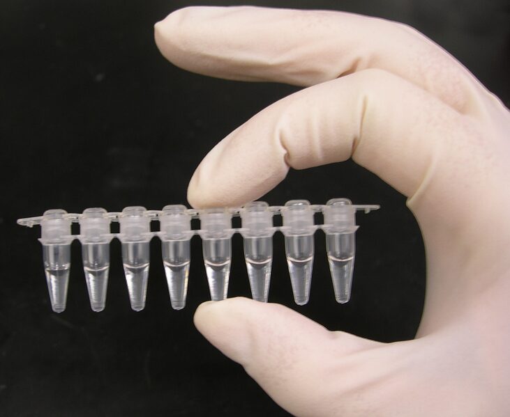 “PCR tubes representing ureaplasma PCR testing and molecular diagnosis”